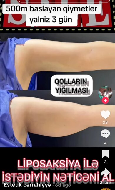 Dr.Ella necə estetik əməliyyatlar icra edir? -Araşdırma