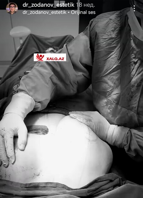 Bu pasiyentlərin çılpaq görüntüləri yayıldı - FOTOLAR