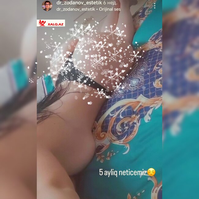 Bu pasiyentlərin çılpaq görüntüləri yayıldı - FOTOLAR