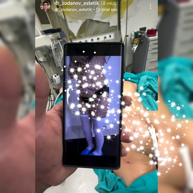 Bu pasiyentlərin çılpaq görüntüləri yayıldı - FOTOLAR