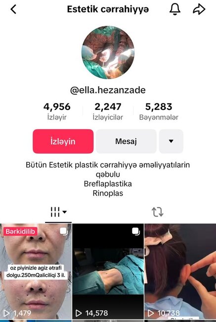 Dr.Ella necə estetik əməliyyatlar icra edir? -Araşdırma