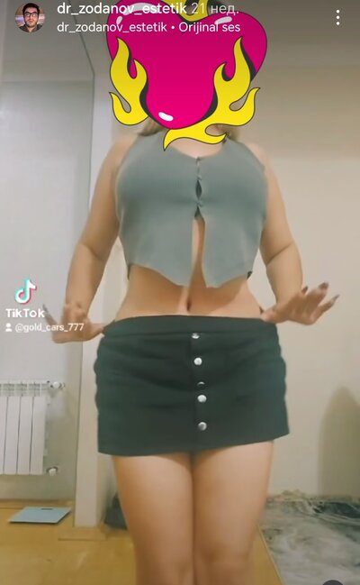 Bu pasiyentlərin çılpaq görüntüləri yayıldı - FOTOLAR