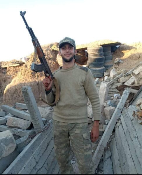 Komada olan ƏSGƏRİMİZ DÜNYASINI DƏYİŞDİ - FOTO