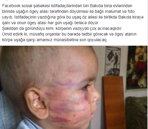 Bakıda ögey ata azyaşlı körpəni VƏHŞİCƏSİNƏ DÖYDÜ - FOTO