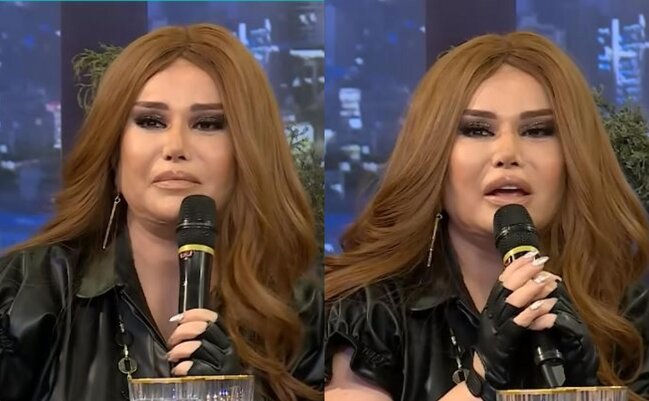 Plastik əməliyyat etdirən Nazəninin gözünə nə olub? - FOTOLAR