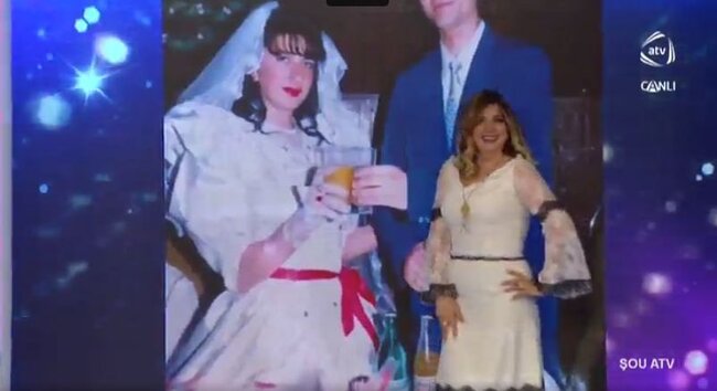 Estetik əməliyyatla dəyişən azərbaycanlı məşhur xanımın toy görüntüləri şok etdi - FOTOLAR
