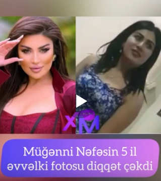 Nəfəsin estetik əməliyyatdan öncəki FOTOsu müzakirələr yaratdı