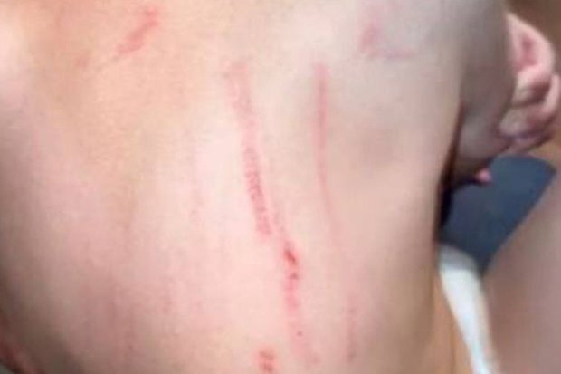 2 yaşlı uşaq bağçadan bu vəziyyətdə gəldi - FOTO