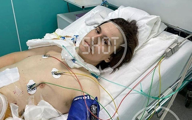 Permdə atışma törədən şəxsin reanimasiyadan FOTOSU