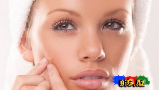 Sızanaqlardan xilas olmağın asan yolları