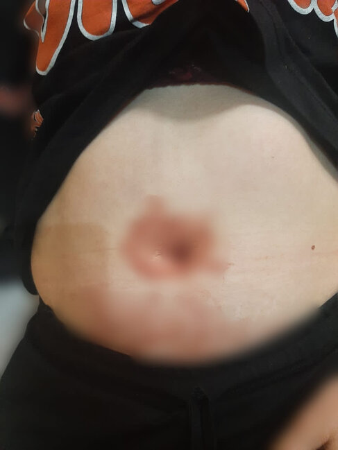 Küçədə qaçırılan qadınla bağlı ŞOK DETALLAR - Gələn gündən şiddət görür - FOTO - YENİLƏNİB