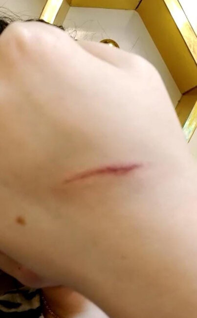 Küçədə qaçırılan qadınla bağlı ŞOK DETALLAR - Gələn gündən şiddət görür - FOTO - YENİLƏNİB