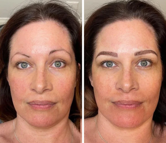 Qaş forması insanı belə dəyişir – FOTOLAR