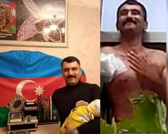 Qolunu itirən qazimizin ÖVLADI OLDU- FOTO