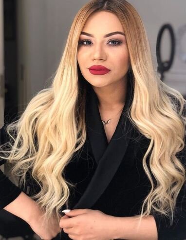 "Ölə bilərdim, o qəzadan sağ çıxmışamsa..." - Dəhşətli qəzada ayağı və çiyni sınan Türkan