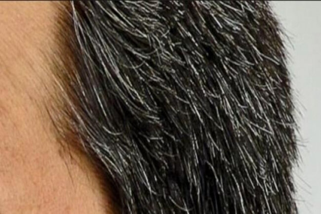 Saçlar niyə erkən ağarır? - SƏBƏB