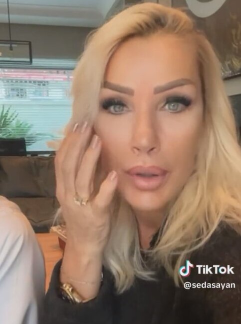 Seda Sayan gənc görünmək üçün bunu da etdi: Sünnət dərisindən... - FOTO+VİDEO