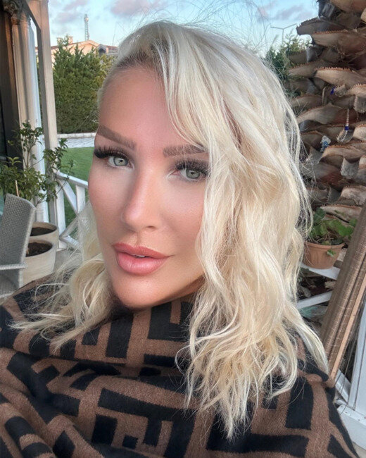 Seda Sayan gənc görünmək üçün bunu da etdi: Sünnət dərisindən... - FOTO+VİDEO