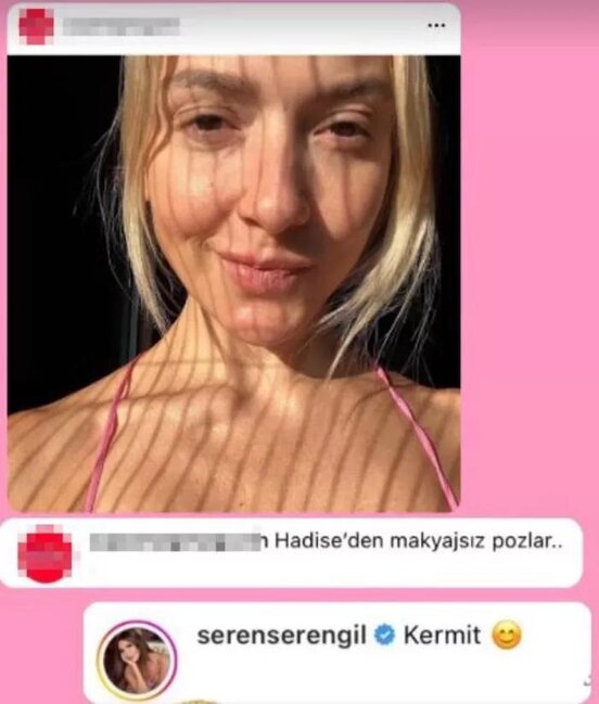 Seren Serengil Hadisəni "qurbağa" adlandırdı - Foto