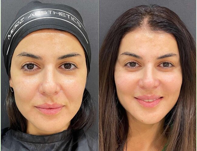 Sevincin estetiklə dəyişimi