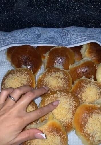 Barmağındakı nişan üzüyüdür? - Foto