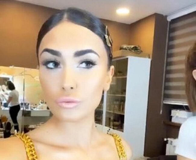 Pərvin indi də dodaqlarını böyütdürdü - Fotolar