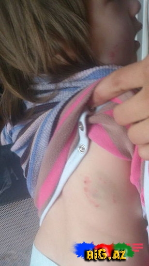 "Səadətin bədənində əzik və dişlək yerləri var"- FOTO