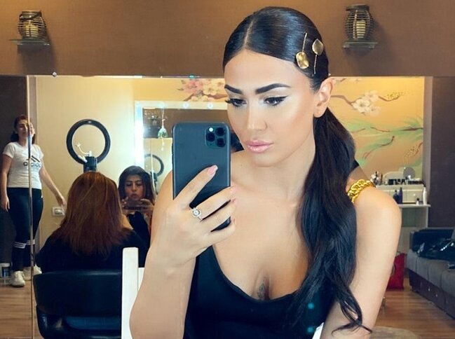 Pərvin indi də dodaqlarını böyütdürdü - Fotolar
