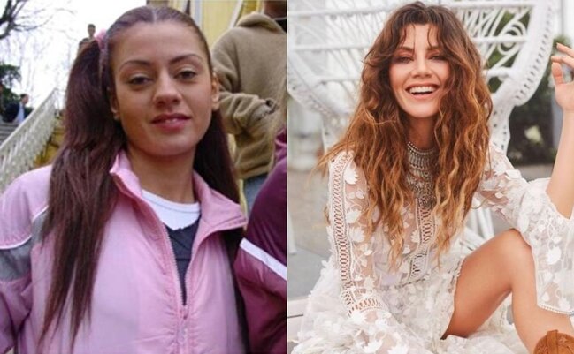 Gökce Bahadırın estetiklərini ortaya çıxaran - Fotolar