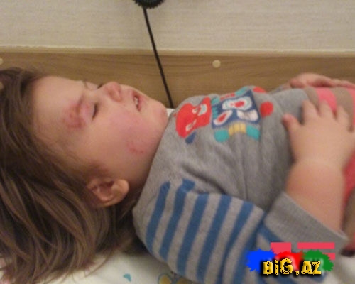 "Səadətin bədənində əzik və dişlək yerləri var"- FOTO