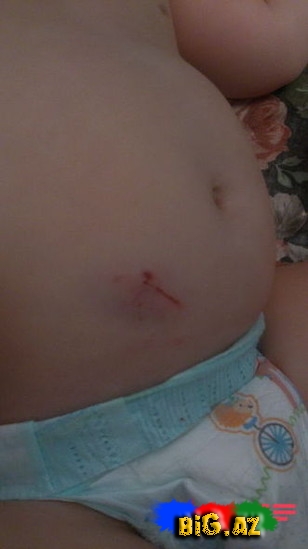 "Səadətin bədənində əzik və dişlək yerləri var"- FOTO