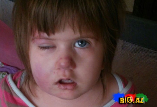 "Səadətin bədənində əzik və dişlək yerləri var"- FOTO