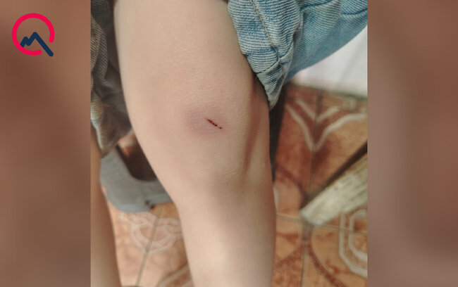 "4-cü sinif şagirdi nəvəmi məktəbin ayaqyolunda döyüb" - Foto