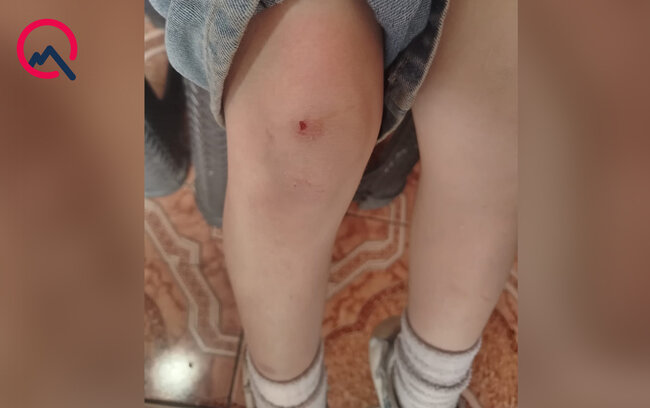 "4-cü sinif şagirdi nəvəmi məktəbin ayaqyolunda döyüb" - Foto