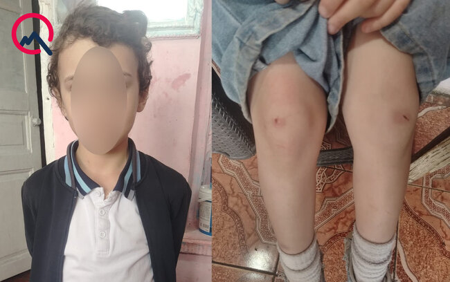 "4-cü sinif şagirdi nəvəmi məktəbin ayaqyolunda döyüb" - Foto