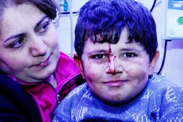 Gəncə terrorunun canlı şahidləri: Balaca Bəxtiyar üç il sonra - VİDEO