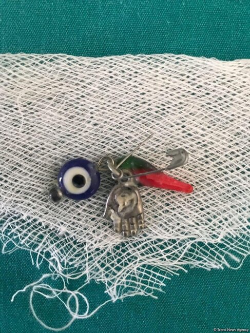 Gözdəyməmək üçün vurmuşdular, körpə uddu - Azərbaycanda+Foto