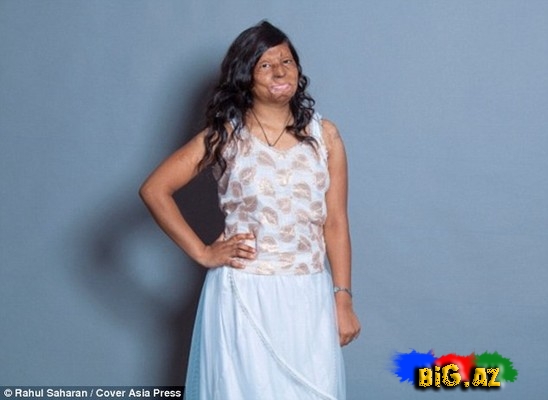 Turşu hücumuna yox - FOTO