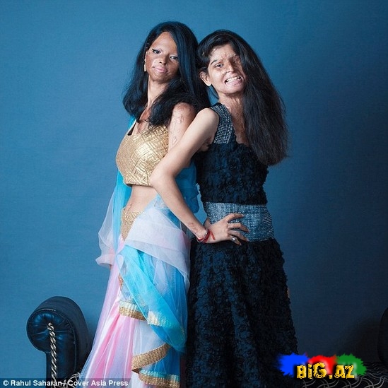 Turşu hücumuna yox - FOTO