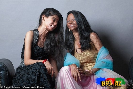 Turşu hücumuna yox - FOTO