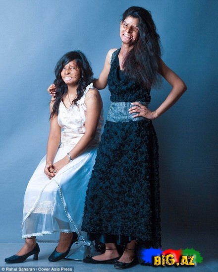 Turşu hücumuna yox - FOTO