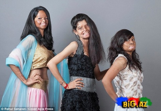 Turşu hücumuna yox - FOTO