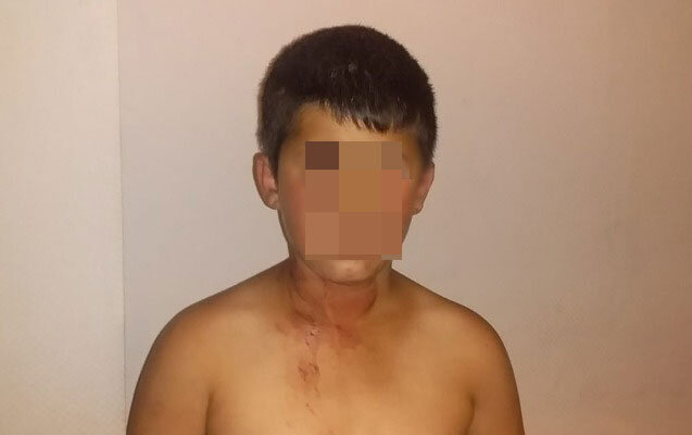Ata dilənmək istəməyən 11 yaşlı oğlunu başından bıçaqladı - Fotolar
