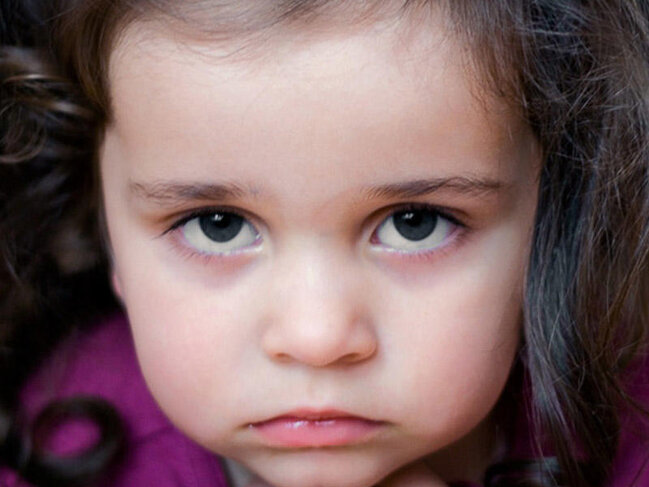 Uşaqların gözlərinin altı niyə qaralır? 8 ən yayılmış səbəb