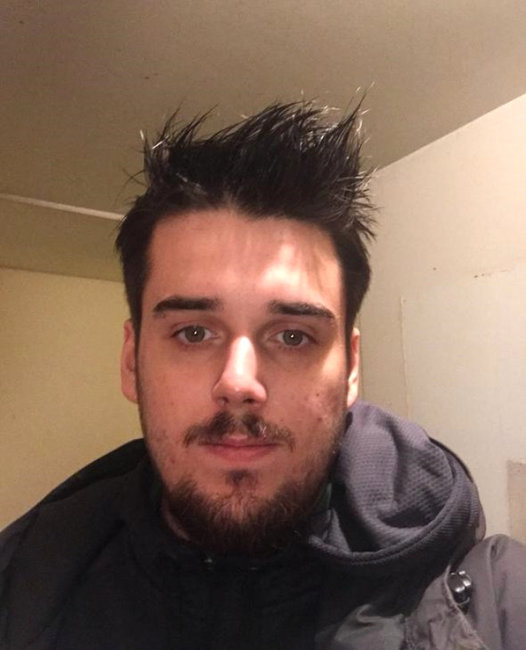 Sifətini gülləylə vurub paramparça etdi - Başqa insanın üzü ilə yenidən həyata qayıtdı - FOTOLAR