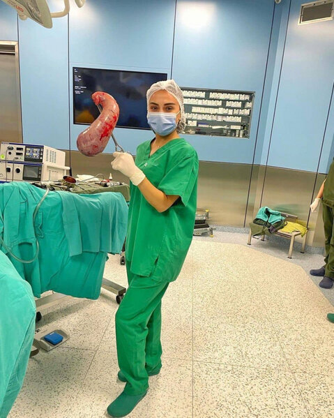 Vüsalə bacısının mədəsini əlində saxladı - FOTO