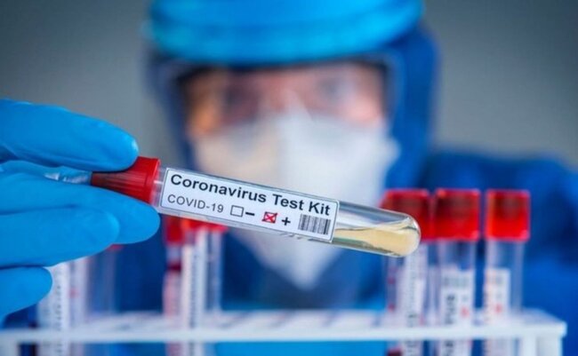 Son sutkada koronavirusdan ölüm qeydə alınmadı