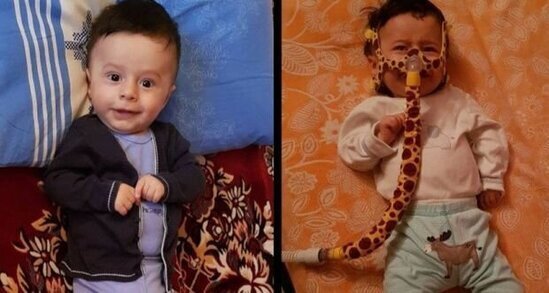 SMA xəstəsi olan uşaqların valideynlərinə ŞAD XƏBƏR