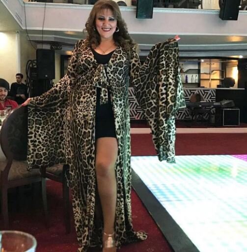 Aktrisanın qısa ətəyi TƏNQİD EDİLDİ — FOTO