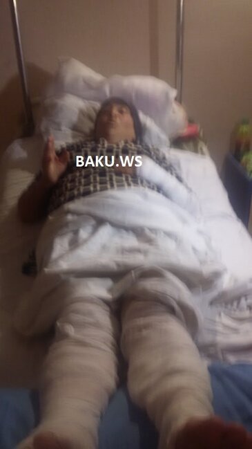 Yaşlı qadının üstünə benzin töküb yandırdılar – Azərbaycanda DƏHŞƏT – FOTO